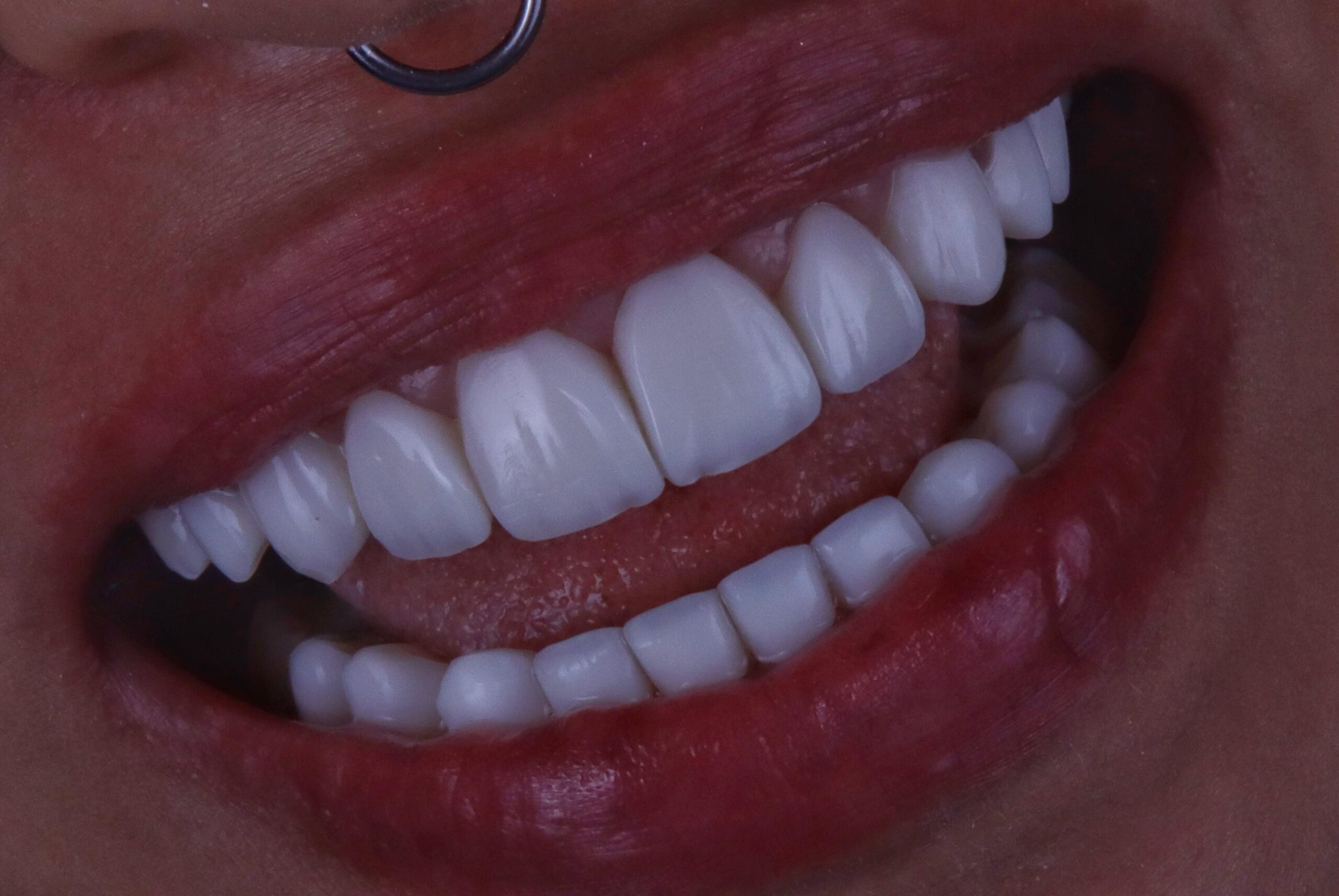 WhatsApp-Image-2025-07-15-at-10.56.28-scaled